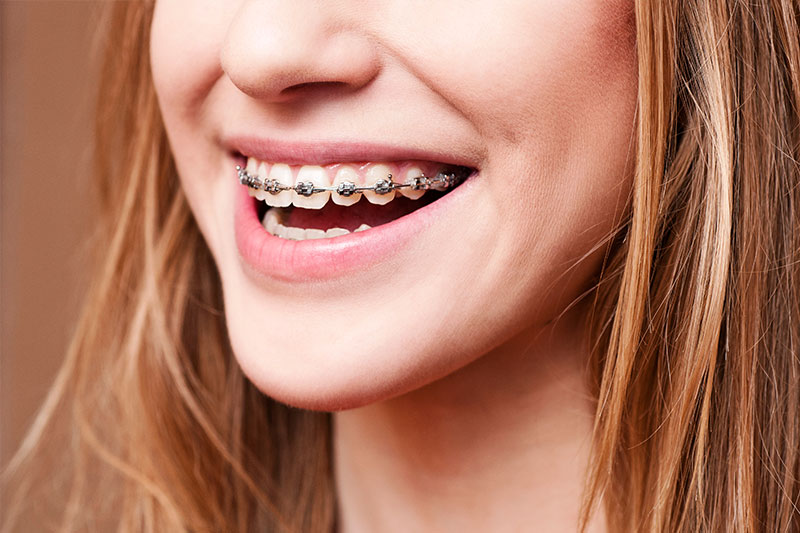 Orthodontics in Mamaroneck